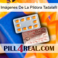 Imágenes De La Píldora Tadalafil new13